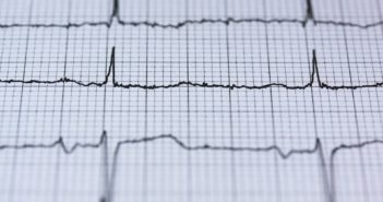 EKG - Messung des Herzschlags