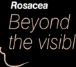 Rosacea Beyond the visible