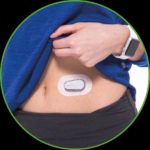 Smarte Kontrolle: ein kleiner Sensor misst im Unterhautfettgewebe den Glukosewert,