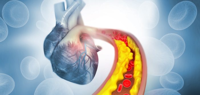 Skizze eines Herzen - Cholesterinzufuhr
