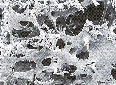 Knochenschwund - gute Knochenstruktur
