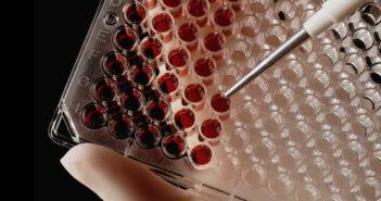 Eine Blutprobe wird für ein Labor vorbereitet